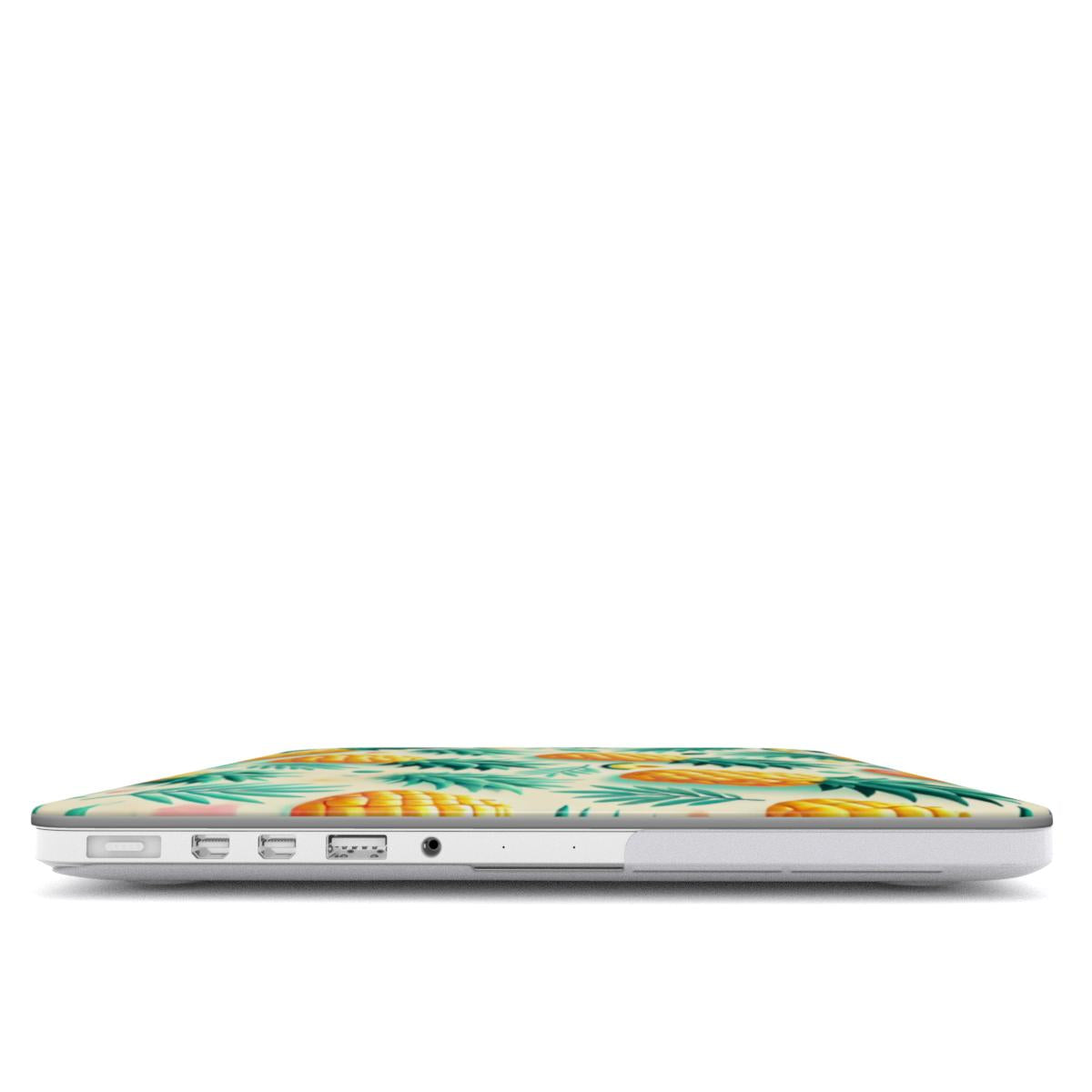 Pineapple MacBook Case
