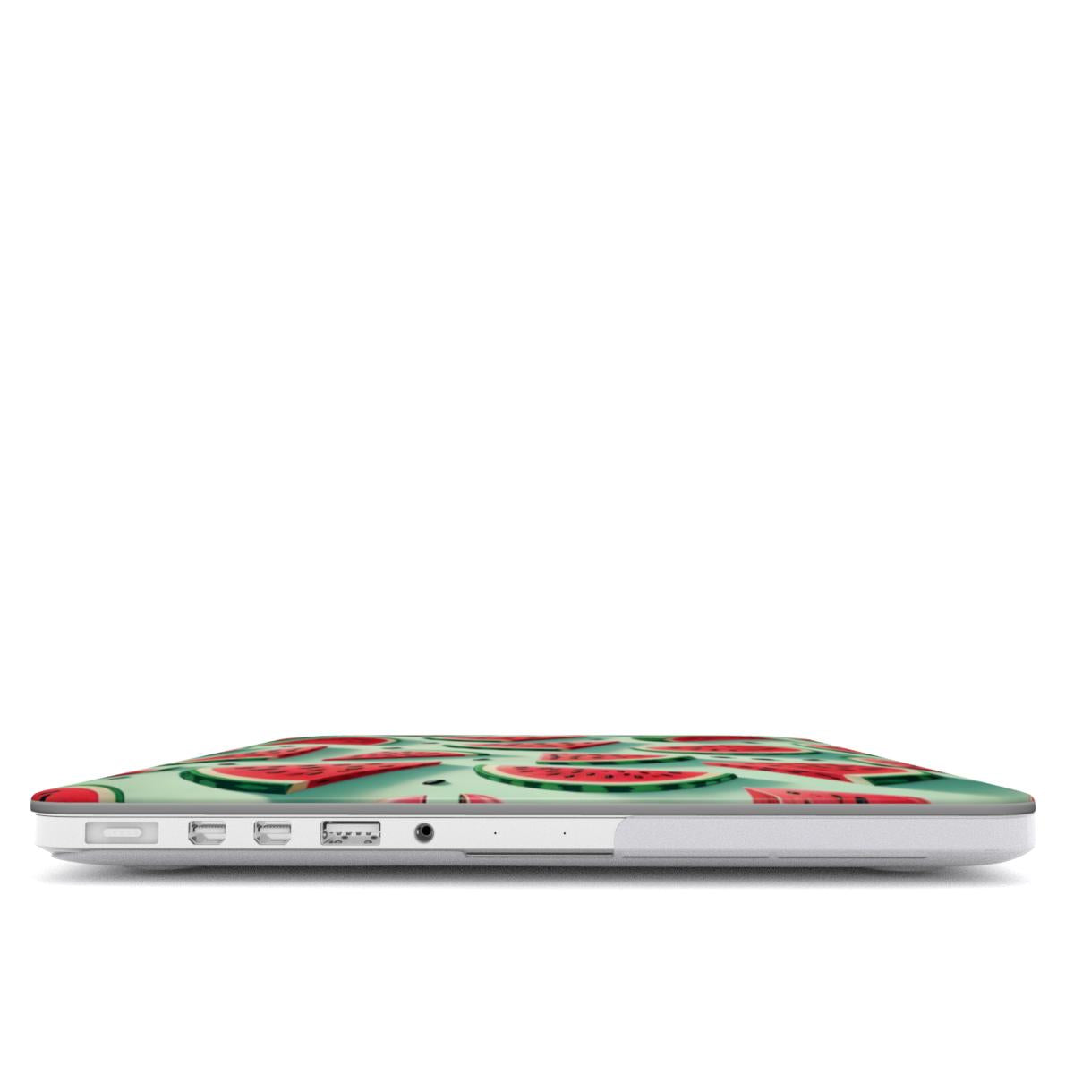 Watermelon MacBook Case