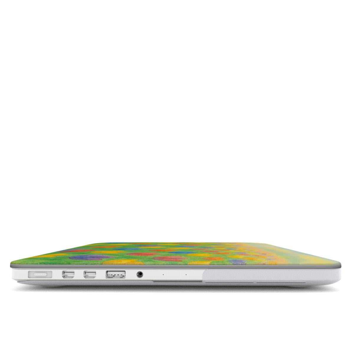 Tulips MacBook Case